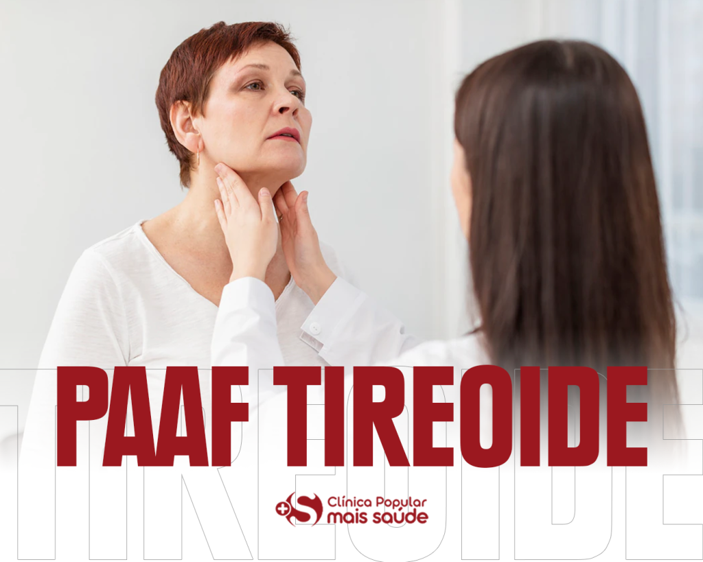 Paaf PAAF da Tireoide - Clínica Popular Mais Saúde Anápolis